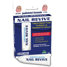 Load image into Gallery viewer, Ozhealth Podiatrist Formula Nail Revive 20ml