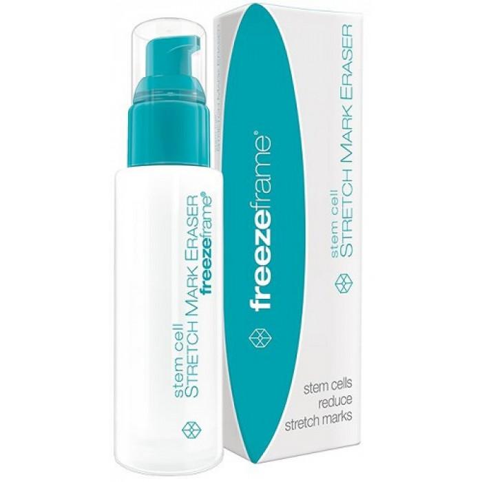 Freezeframe Stem Cell Stretch Mark Eraser 80mL